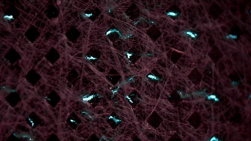 BPhys GD 4ADS 36a udb 13 wochen.jpg